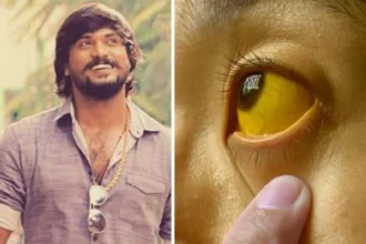 ಜಾಂಡೀಸ್​ಗೆ ನಟ ಸಂತೋಷ್​ ನಿಧನ! ಎಷ್ಟು ಅಪಾಯಕಾರಿ ಈ ಕಾಯಿಲೆ? ರೋಗ-ಲಕ್ಷಣಗಳೇನು? ಇಲ್ಲಿದೆ ಮಾಹಿತಿ | Jaundice